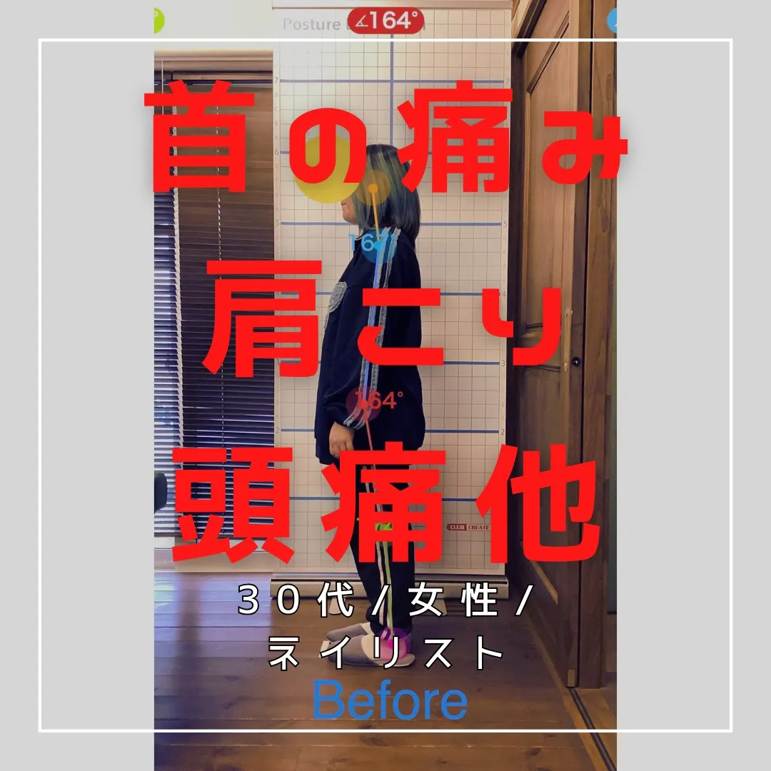 【富里 整体】頭痛、首の痛み、肩こり 他/30代女性/ネイリ...