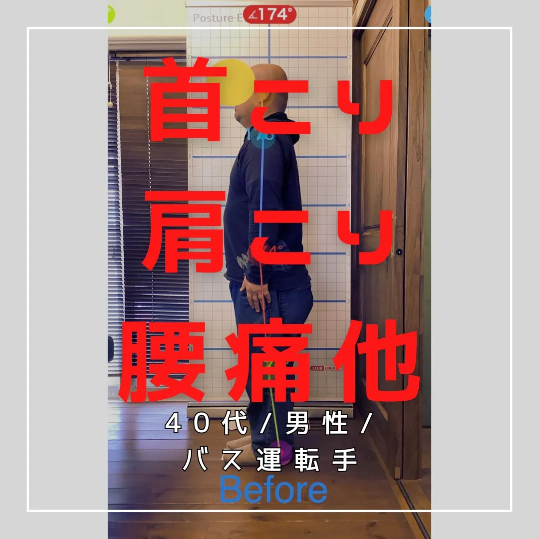 【富里 整体】腰痛、首こり、肩こり 他/40代男性/バス運転...