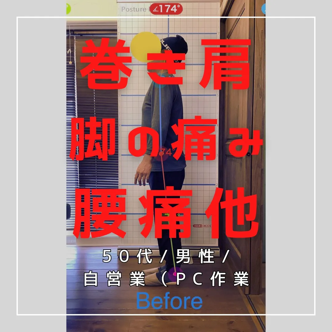 【富里 整体】巻き肩、脚の付け根の痛み、腰痛 他/50代男性...