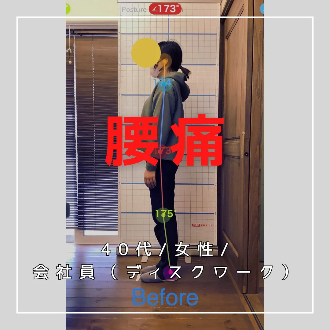 【富里 整体】腰痛/40代女性/会社員(ディスクワーク)