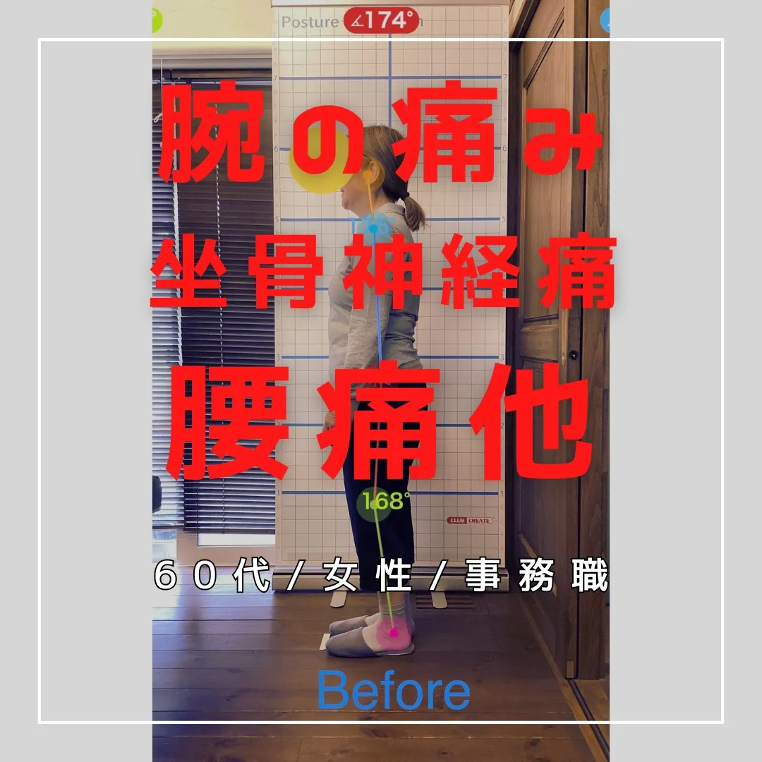【富里 整体】坐骨神経痛、腕の痛み、腰痛 他/60代女性/事...