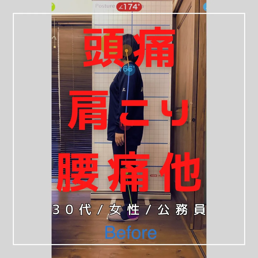 【富里 整体】腰痛、肩こり、頭痛 他/30代女性/公務員