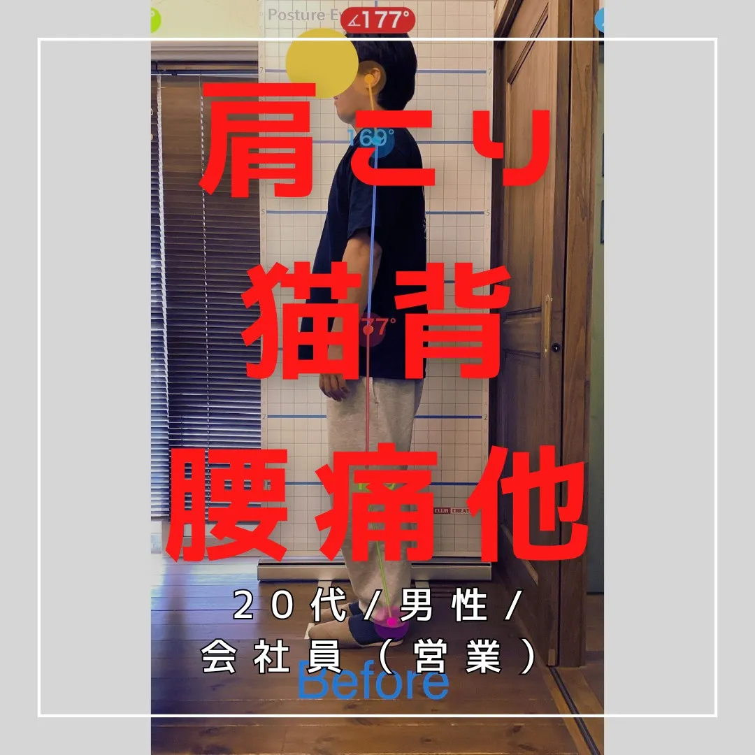【富里 整体】肩こり、猫背、腰痛 他/20代男性/会社員(営...