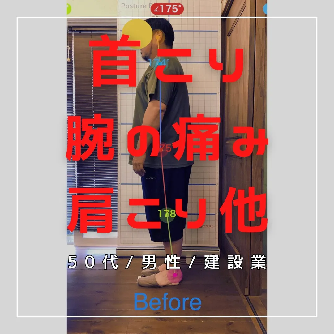 【富里 整体】首こり、肩こり、腕の痛み 他/50代男性/建設...